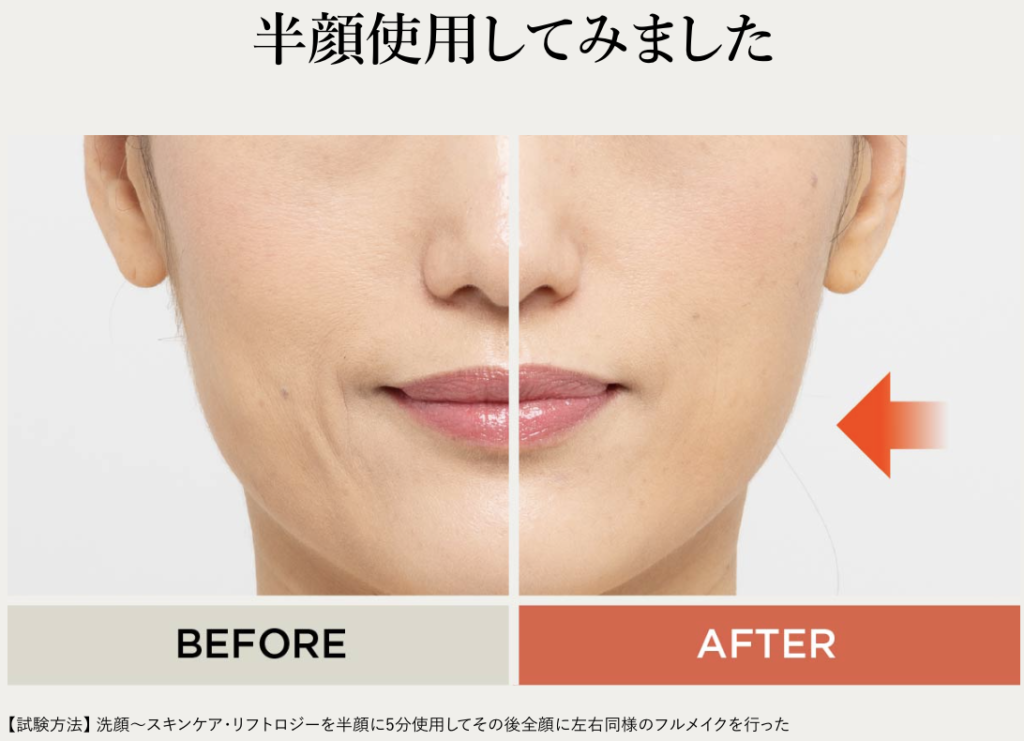 リフトロジーSPを実際に使った画像