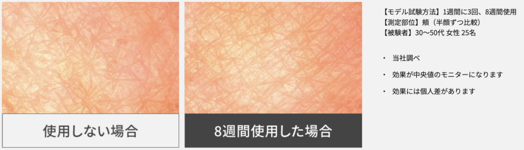 フォトブライトショットを8週間使用したお肌の状態比較
