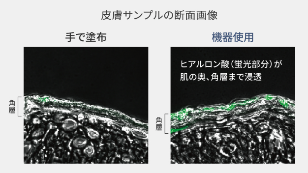 手塗りと比べてヒアルロン酸12倍、コラーゲン6.3倍も角層まで浸透