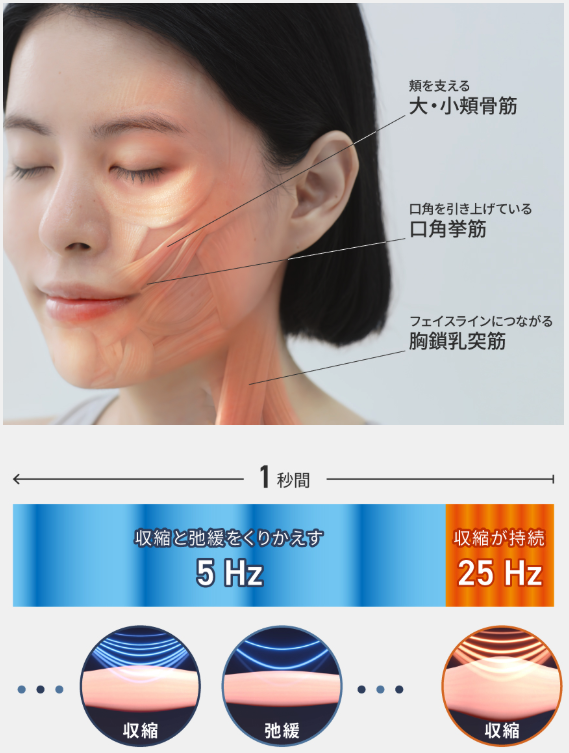 デュアルダイナミックEMS
